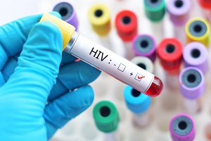 HIV & Herpes